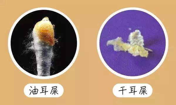 耳耵聍的最新研究与应用