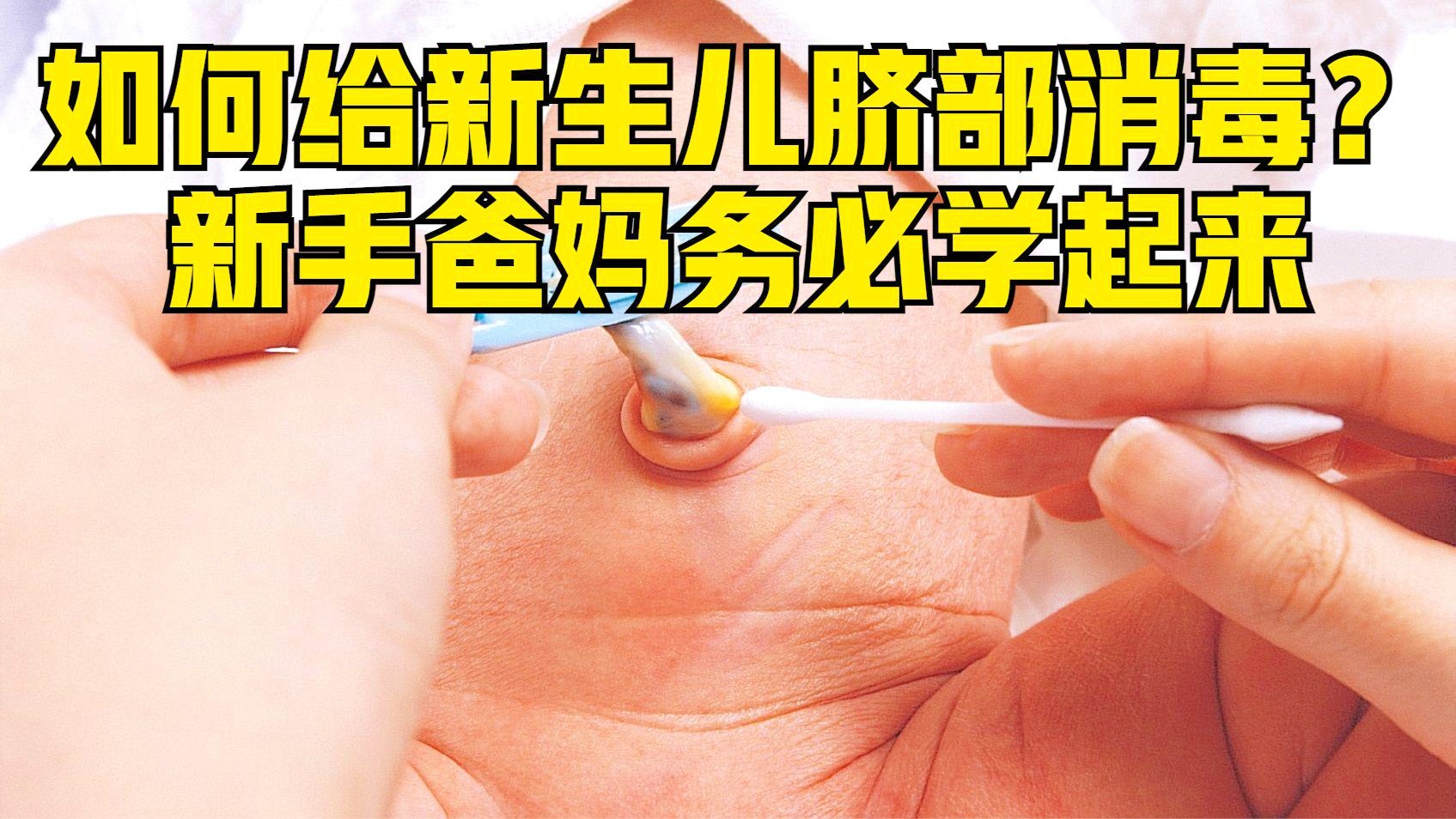 最新脐带消毒技术，守护新生儿健康的生命线